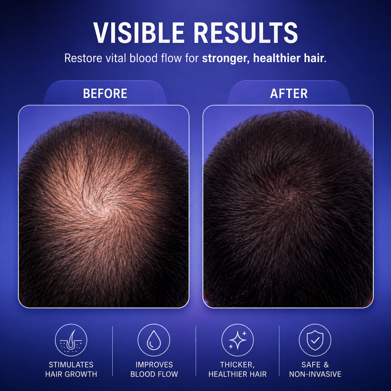 Restore Growth - Advanced Red Light Hair Therapy Cap Restore Motion