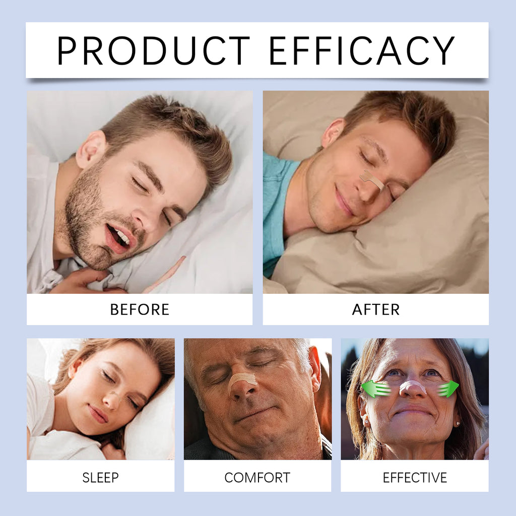 Nasal Strips - Open Your Airways & Increase Oxygen Intake - 30 pack