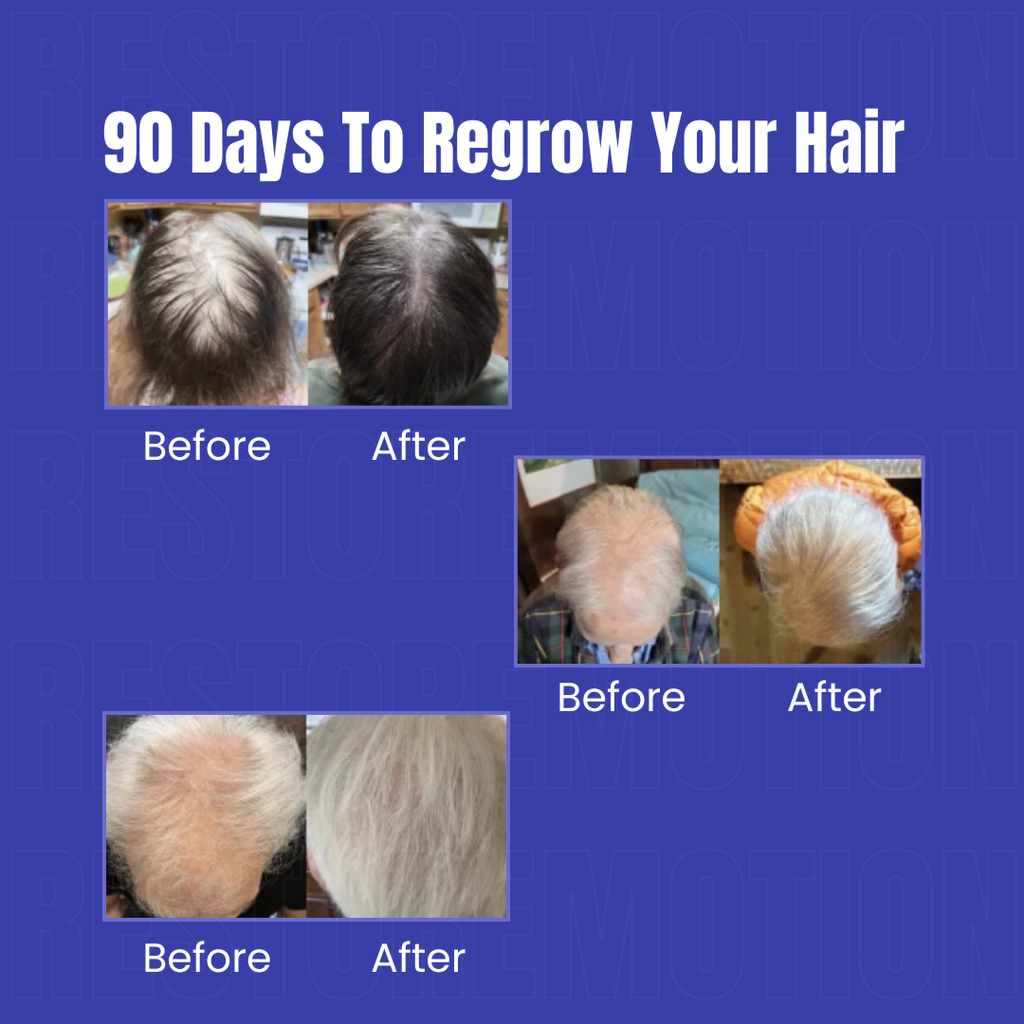 Restore Growth - Advanced Red Light Hair Therapy Cap Restore Motion