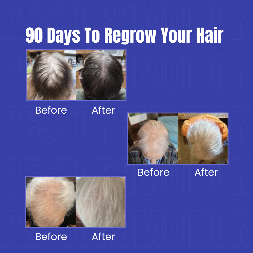 Restore Growth - Advanced Red Light Hair Therapy Cap Restore Motion
