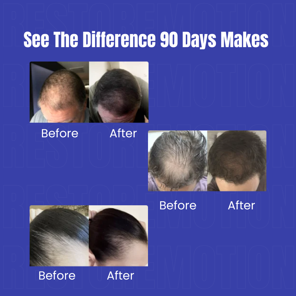 Restore Growth - Advanced Red Light Hair Therapy Cap Restore Motion